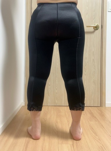 after photo: 허벅지지방흡입