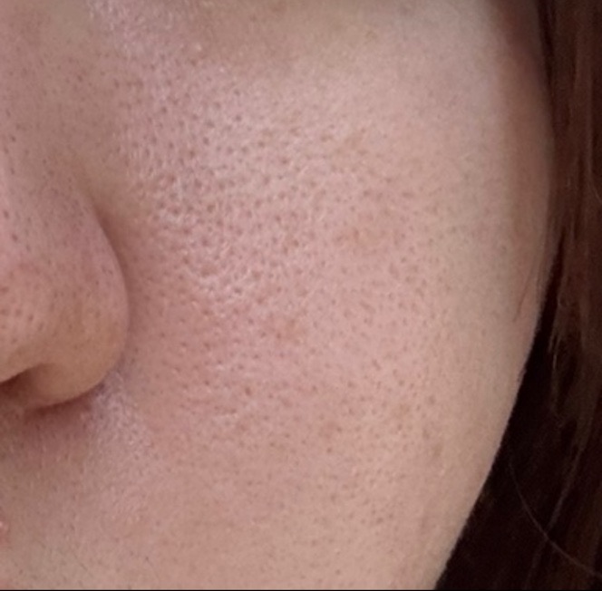 ZX-CLINIC【ゼクスクリニック】の施術口コミ1185件