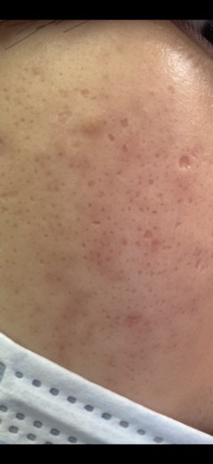 after photo: 쥬베룩