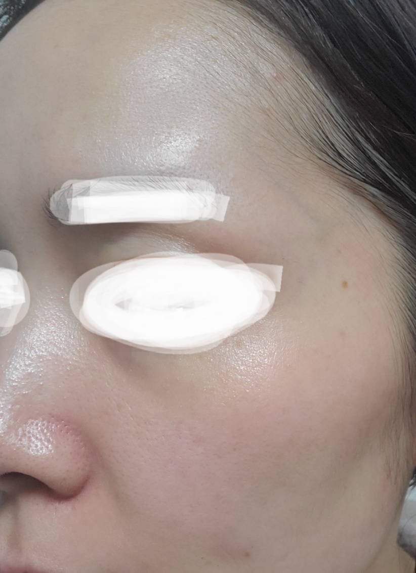 再来OK】ハイドラフェイシャル＋エレクトロポレーション | おおかみ