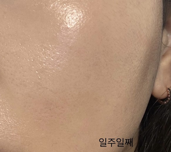 after photo: 쥬베룩