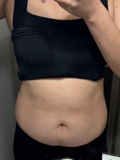 after photo: マンジャロ