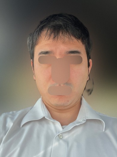 after photo: 白玉注射・点滴