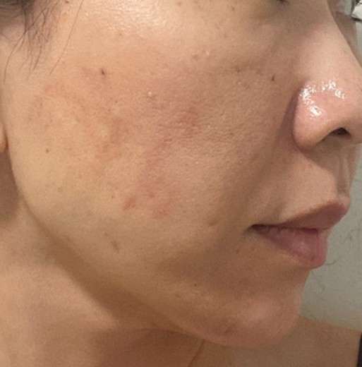 before photo: ルメッカ