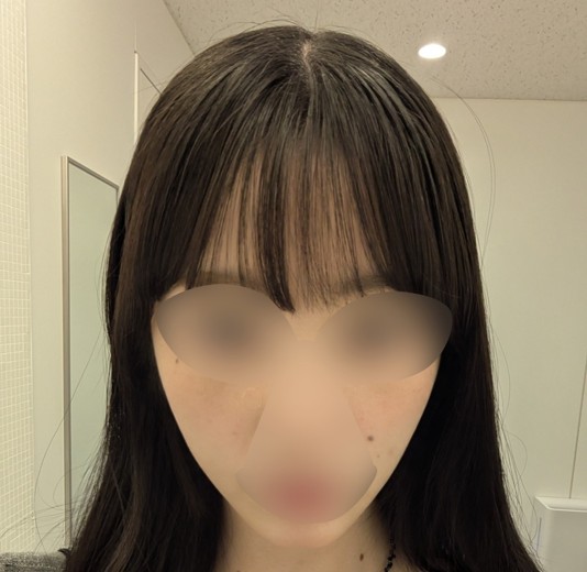 after photo: ウルトラセルZi・リニアZ(ハイフ)