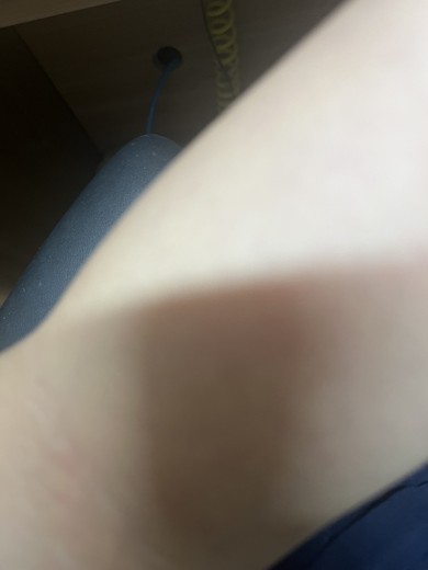 after photo: 팔제모