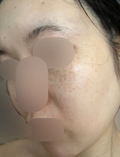 before photo: ルメッカ