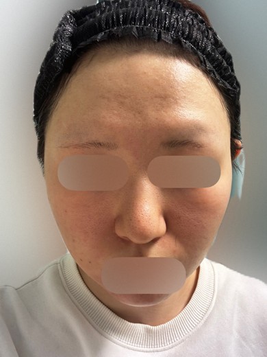 before photo: ポテンツァ(POTENZA), マックーム(McCoom)