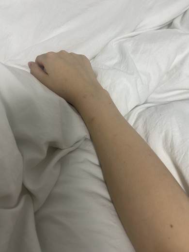 after photo: 白玉注射・点滴