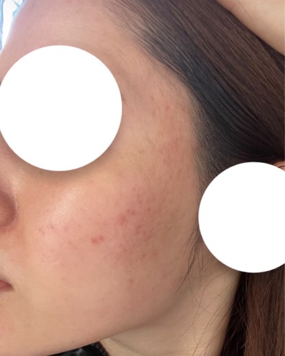 before photo: ルメッカ