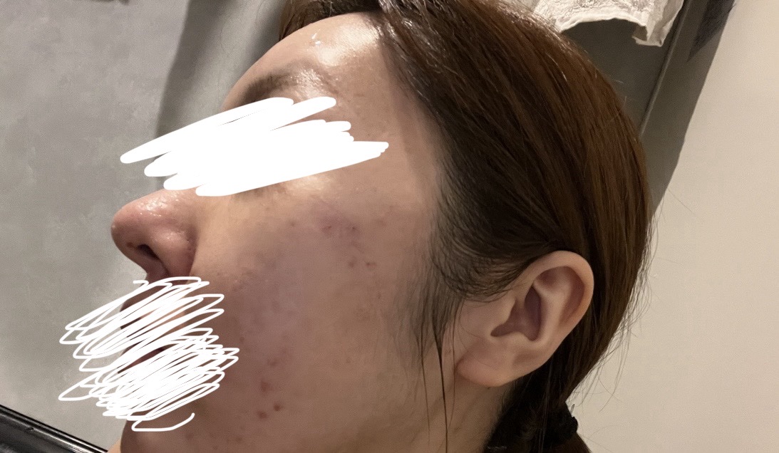 makimaki17171717 コラーゲンピール×2本 楽天市場】＼楽天1位／【全品