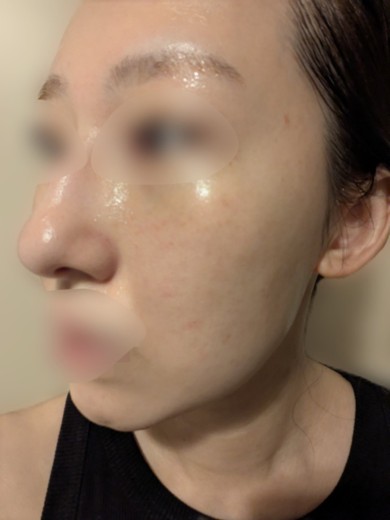 after photo: ルメッカ