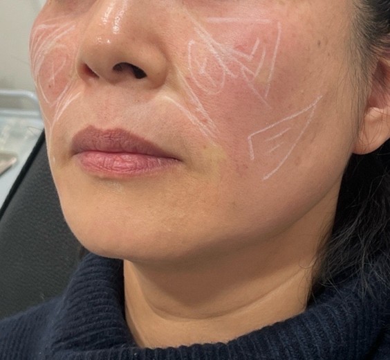 before photo: 쥬베룩