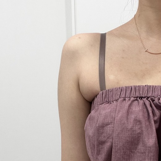 after photo: 팔지방분해주사