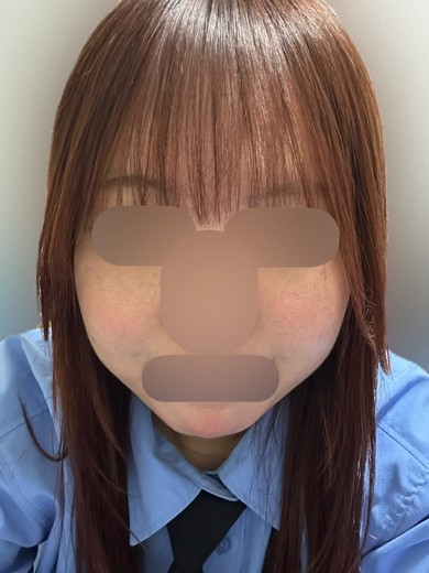 after photo: マックーム(McCoom)