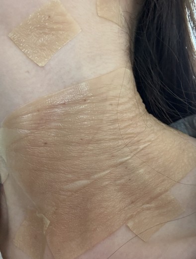 after photo: 착색토닝