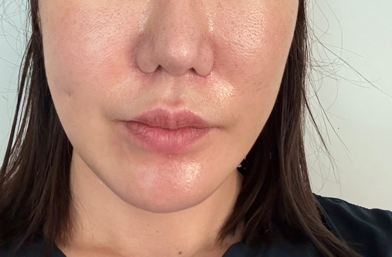 before photo: 엘라비에리투오