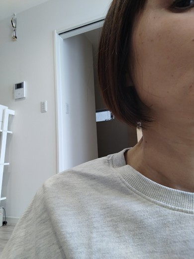 before photo: ピコトーニング
