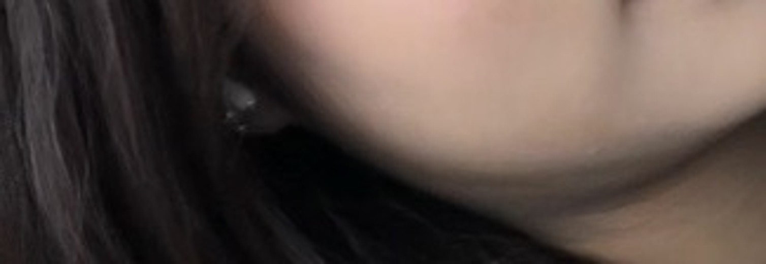 after photo: 인모드리프팅