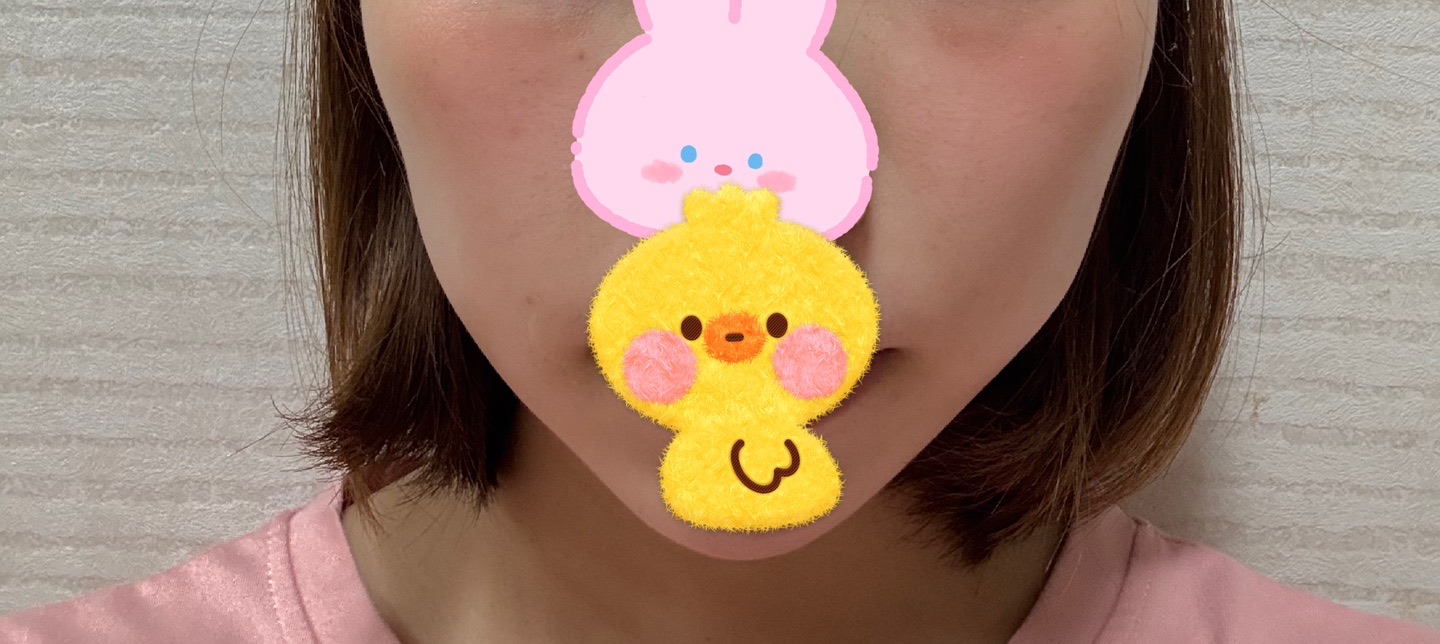 イタリア製 ♧ 口顎首のEx-voto ポテンツァ ダイヤモンドチップ（全顔300ショット）たるみ・引き締めに