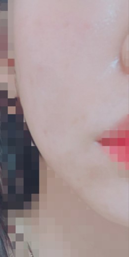 after photo: 리니어지