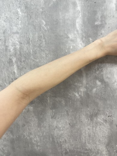 after photo: 白玉注射・点滴, ビタミン注射・点滴
