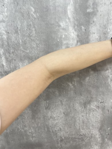 after photo: 白玉注射・点滴, ビタミン注射・点滴