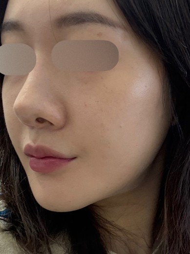 before photo: 쥬베룩