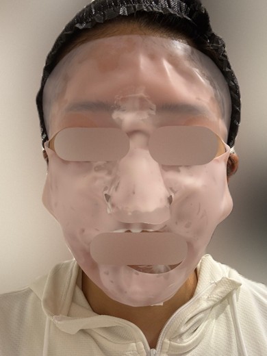 after photo: ジュベルック(Juvelook)