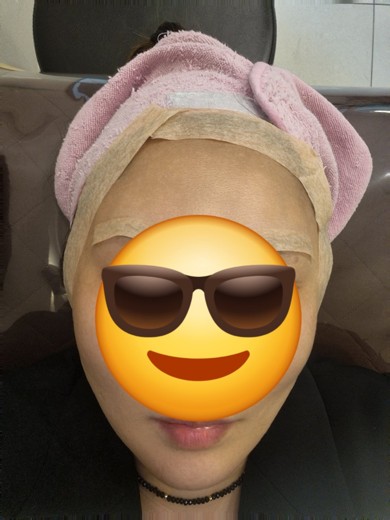 before photo: 피코토닝, 제네시스