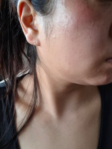 after photo: ルメッカ