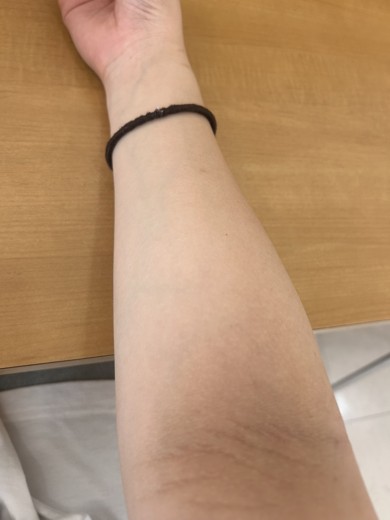 after photo: ビタミン注射・点滴