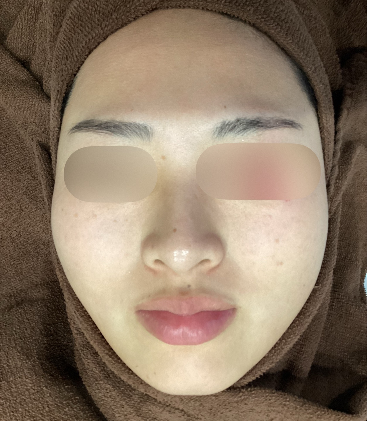 再来OK】ハイドラフェイシャル＋エレクトロポレーション | おおかみ