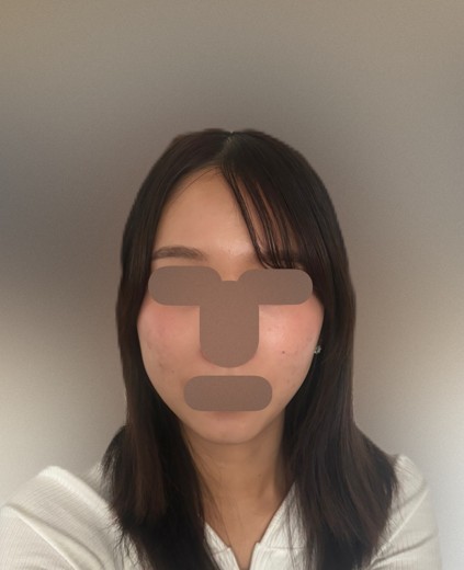 after photo: ヒーライト
