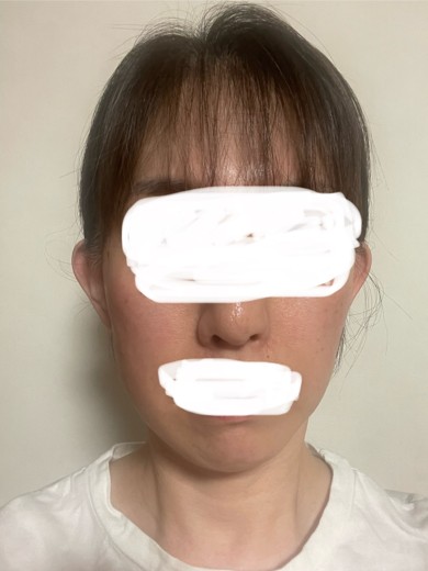 before photo: ソノクイーン(ハイフ)