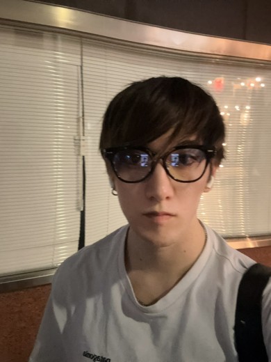after photo: ダーマペン