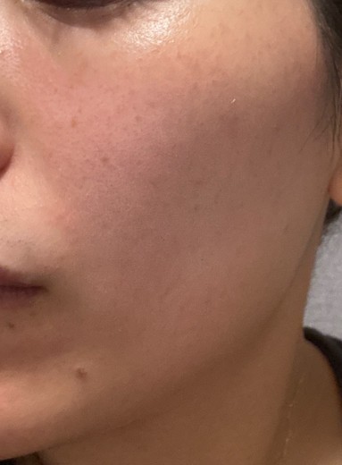 after photo: ルメッカ