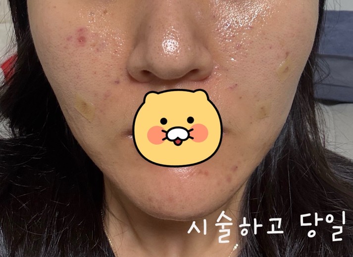 before photo: 쥬베룩