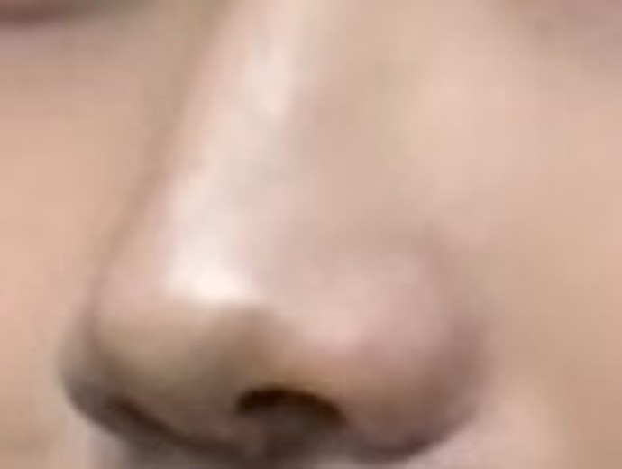 before photo: 코프팅