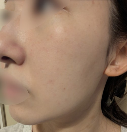 after photo: ルメッカ