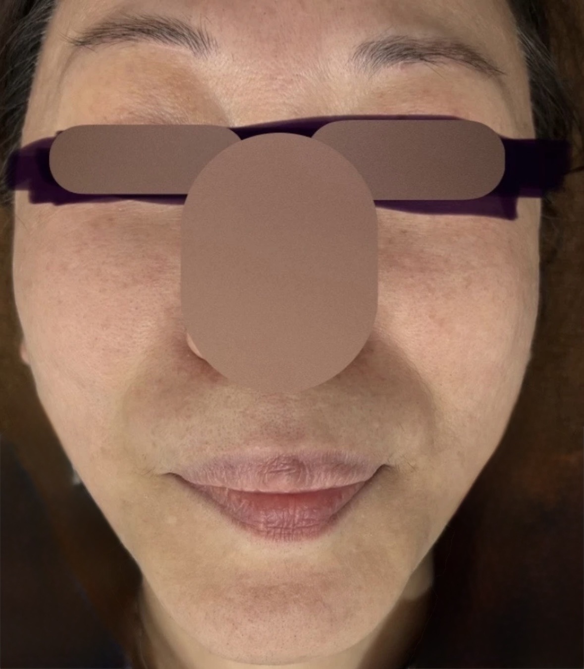 10月15日迄のご予約で初診料0円】ポテンツァ ダイヤモンド