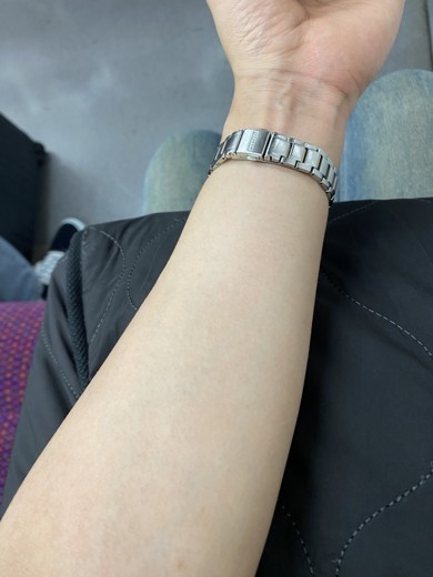 after photo: 白玉注射・点滴