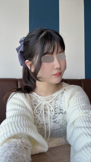 after photo: イオン導入