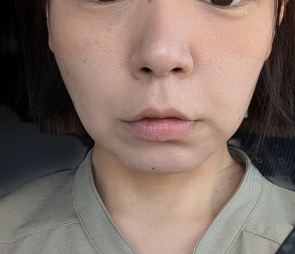 after photo: ソノクイーン(ハイフ)