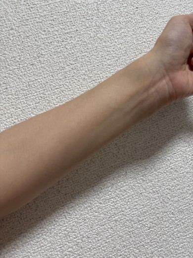 after photo: ビタミン注射・点滴