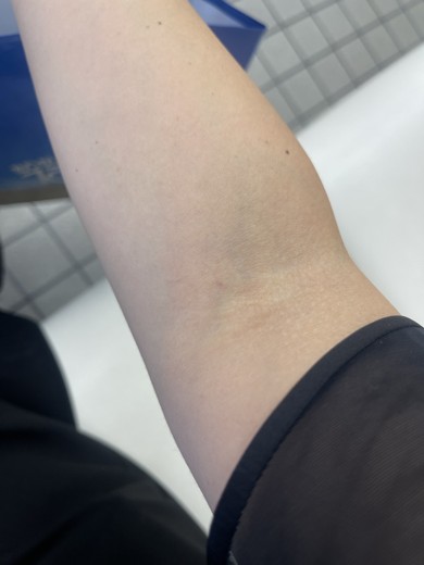 after photo: ダイエット点滴/注射