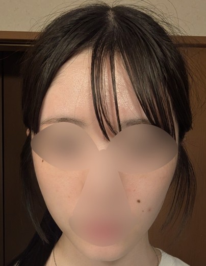 after photo: ウルトラセルZi・リニアZ(ハイフ)