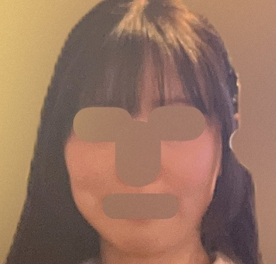before photo: 脂肪溶解注射(腕), 脂肪溶解注射(顔)