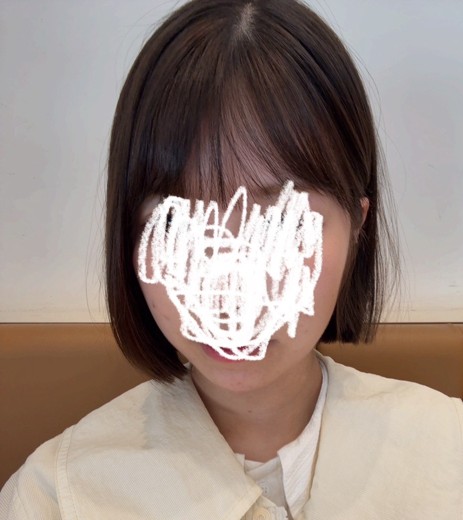 after photo: 턱끝필러