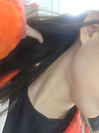 before photo: 침샘보톡스